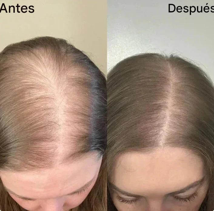 Keratina + Romero + Ortiga + Biotina - Champú Nutritivo y Regenerador para Cabello Grueso y Voluminoso (220 ml) - IdeasLabCo™ - Compre 1 y lleve 1 gratis