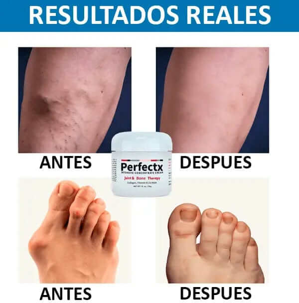 Crema Perfectx® Original importada - Alivia dolor articular y muscular - Compra 1 y lleva 1 GRATIS
