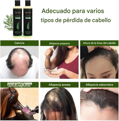 Keratina + Romero + Ortiga + Biotina - Champú Nutritivo y Regenerador para Cabello Grueso y Voluminoso (220 ml) - IdeasLabCo™ - Compre 1 y lleve 1 gratis