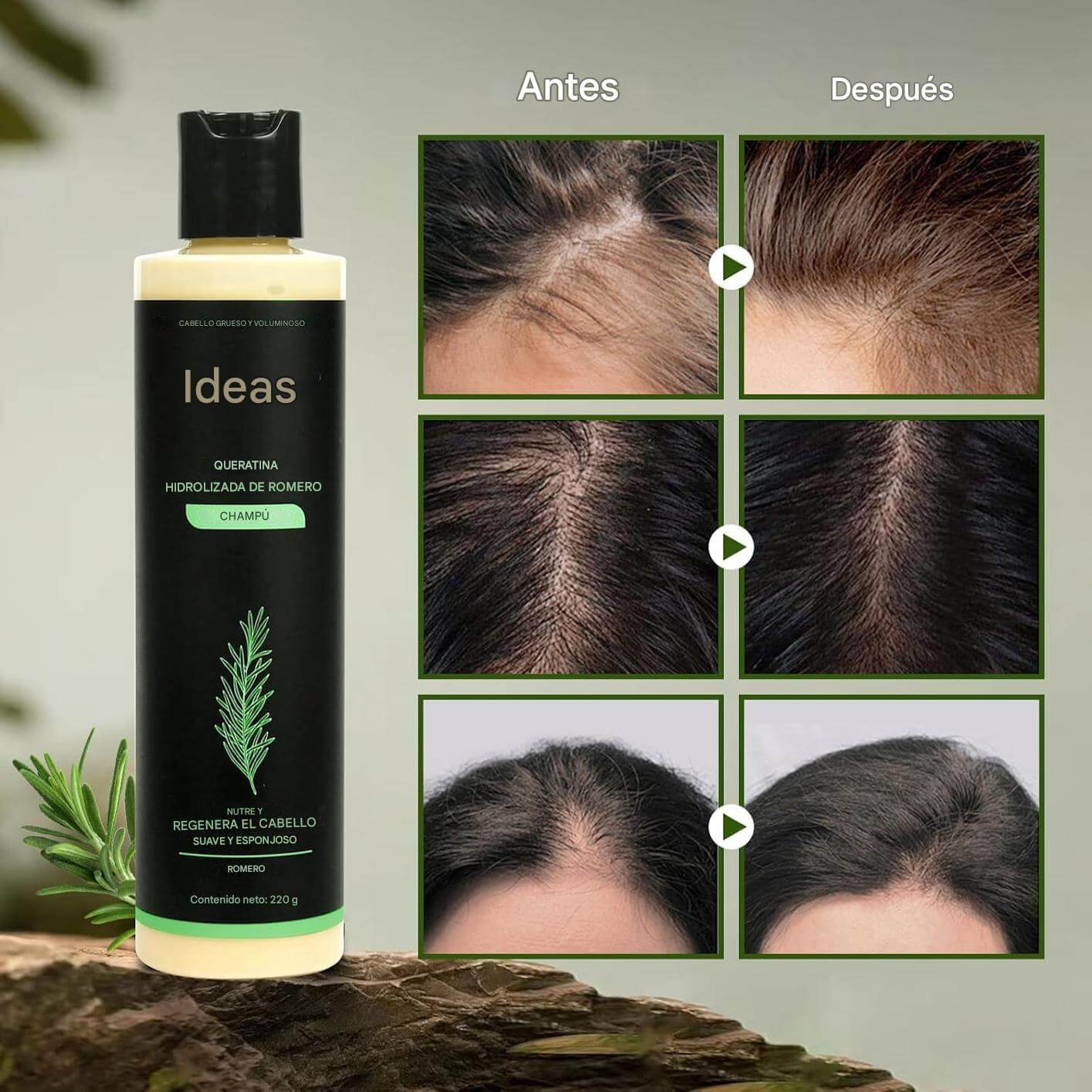 Keratina + Romero + Ortiga + Biotina - Champú Nutritivo y Regenerador para Cabello Grueso y Voluminoso (220 ml) - IdeasLabCo™ - Compre 1 y lleve 1 gratis